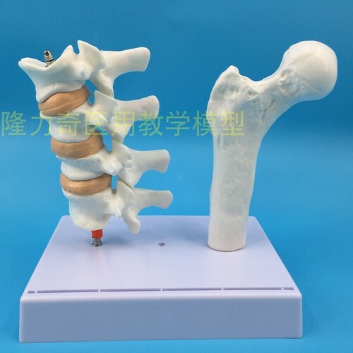 인체 모형 대퇴골 골다공증 해부 모형 다리뼈 척추절단면 표본-624138